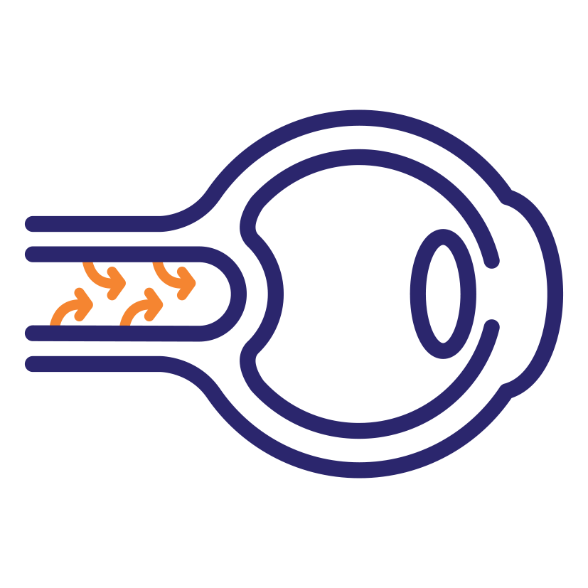 Optic Neuropathy