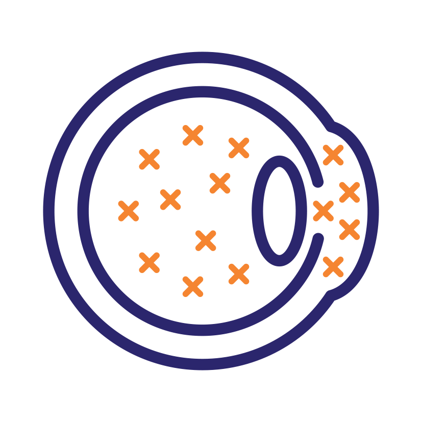 Uveitis